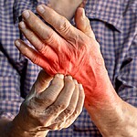 O que significa quando a mão direita coça Confira aqui!